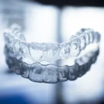 Aparat Invisalign Warszawa