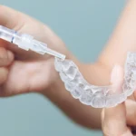 Invisalign dla kogo